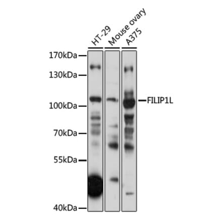 Western Blot - Anti-FILIP1L Antibody (A87908) - Antibodies.com