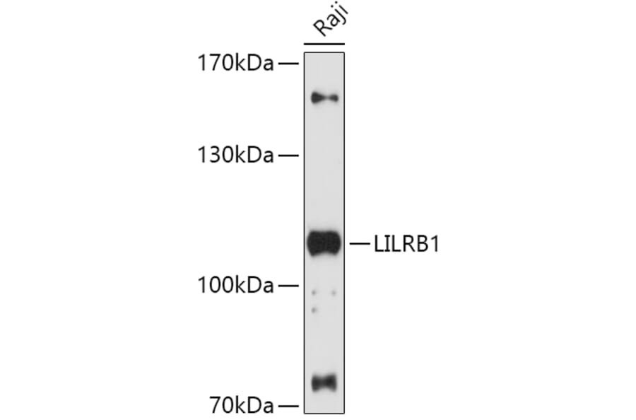 Western Blot - Anti-LILRB1 Antibody (A87909) - Antibodies.com
