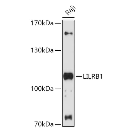 Western Blot - Anti-LILRB1 Antibody (A87909) - Antibodies.com
