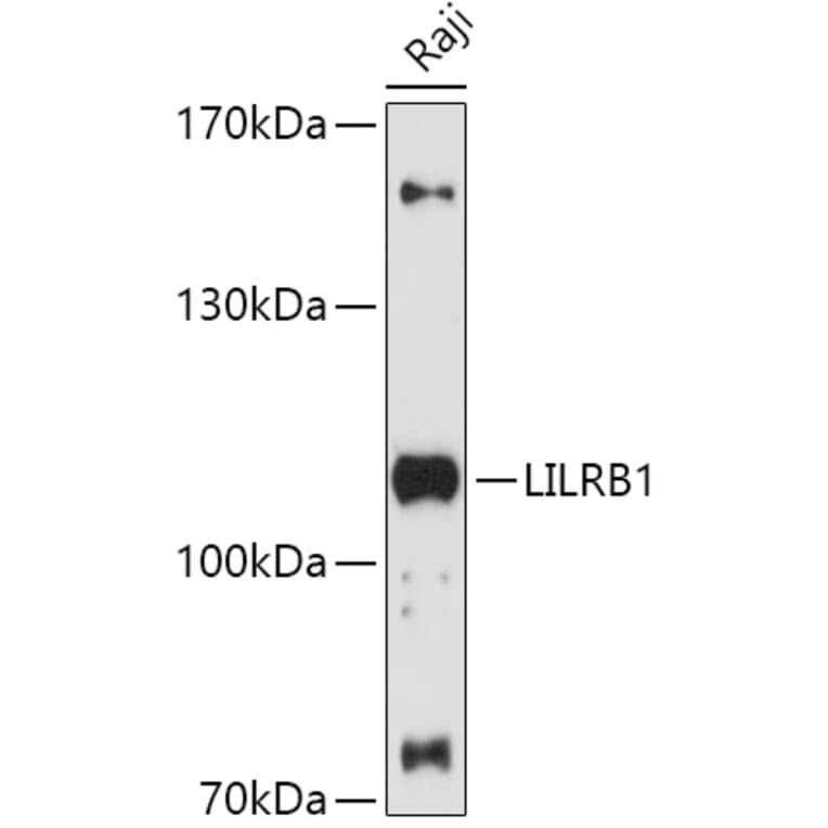 Western Blot - Anti-LILRB1 Antibody (A87909) - Antibodies.com