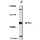 Western Blot - Anti-LILRB1 Antibody (A87909) - Antibodies.com