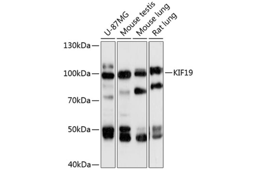 Western Blot - Anti-KIF19 Antibody (A87910) - Antibodies.com