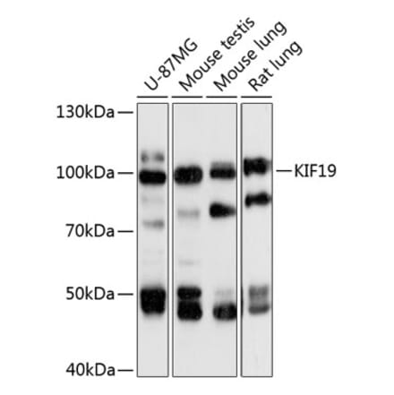 Western Blot - Anti-KIF19 Antibody (A87910) - Antibodies.com