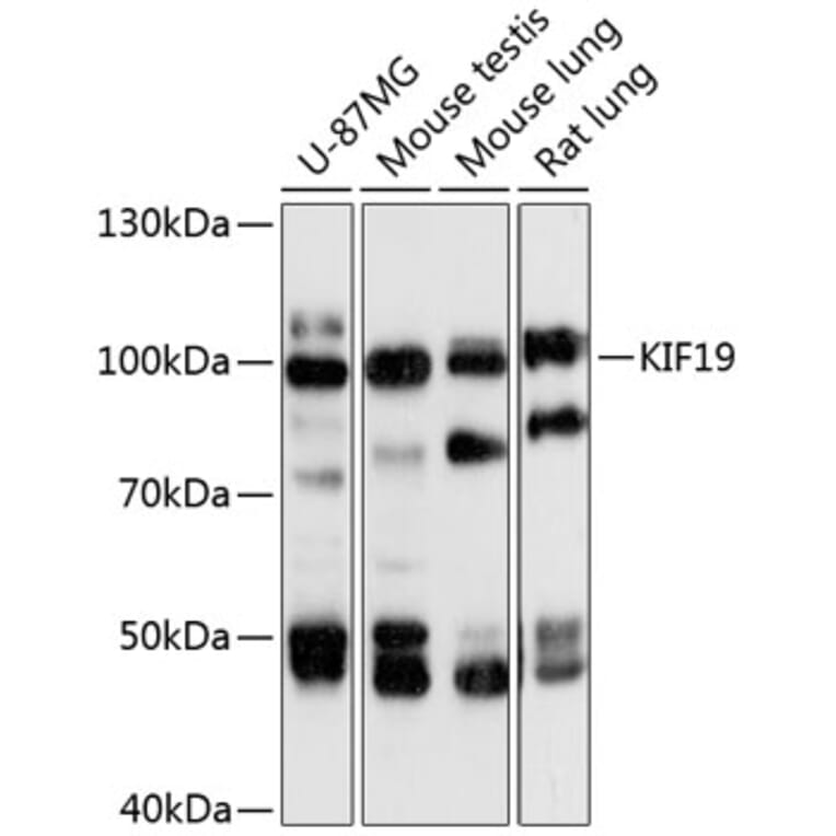 Western Blot - Anti-KIF19 Antibody (A87910) - Antibodies.com