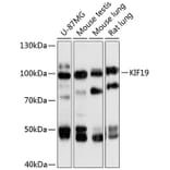 Western Blot - Anti-KIF19 Antibody (A87910) - Antibodies.com