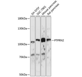 Western Blot - Anti-PTPRN2 Antibody (A87911) - Antibodies.com