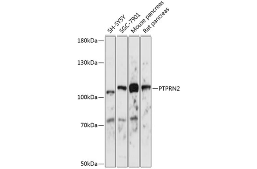 Western Blot - Anti-PTPRN2 Antibody (A87911) - Antibodies.com
