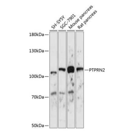 Western Blot - Anti-PTPRN2 Antibody (A87911) - Antibodies.com