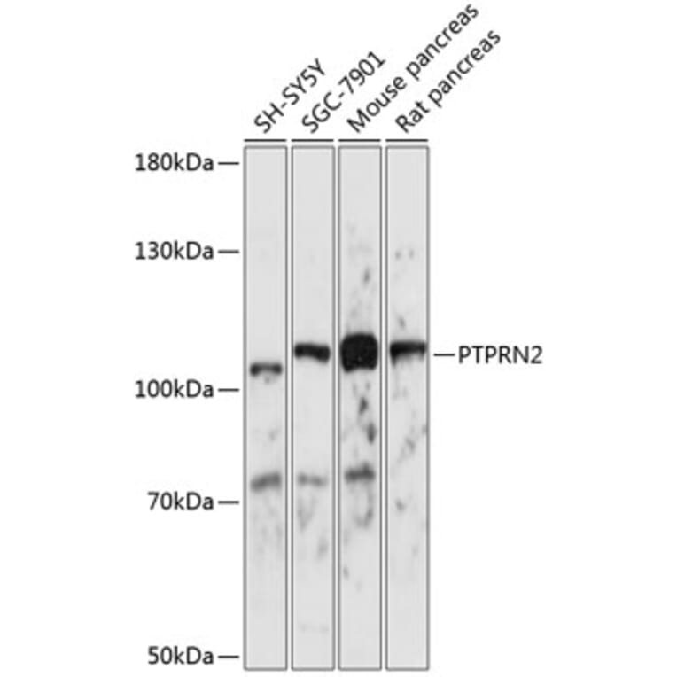 Western Blot - Anti-PTPRN2 Antibody (A87911) - Antibodies.com