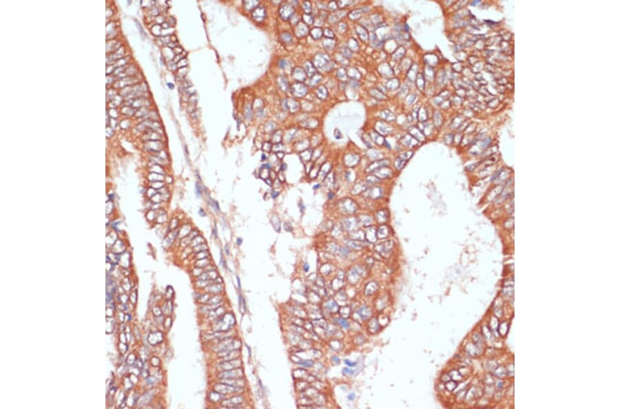 Immunohistochemistry - Anti-PTPRN2 Antibody (A87911) - Antibodies.com