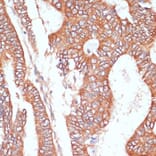 Immunohistochemistry - Anti-PTPRN2 Antibody (A87911) - Antibodies.com