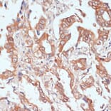 Immunohistochemistry - Anti-PTPRN2 Antibody (A87911) - Antibodies.com