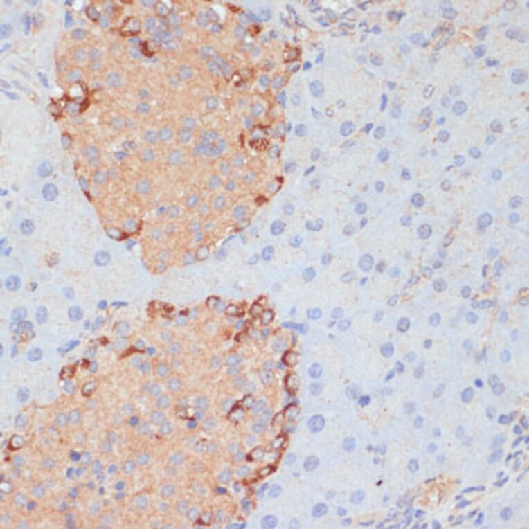 Immunohistochemistry - Anti-PTPRN2 Antibody (A87911) - Antibodies.com