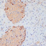 Immunohistochemistry - Anti-PTPRN2 Antibody (A87911) - Antibodies.com