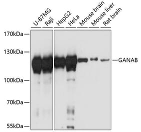 Western Blot - Anti-GANAB Antibody (A87912) - Antibodies.com