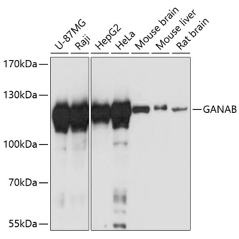 Western Blot - Anti-GANAB Antibody (A87912) - Antibodies.com