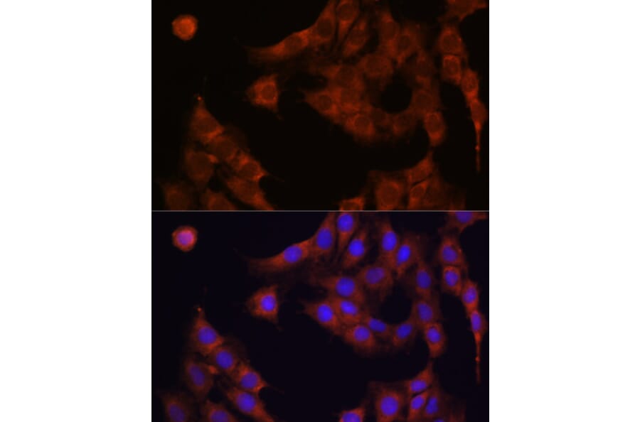Immunofluorescence - Anti-GANAB Antibody (A87912) - Antibodies.com