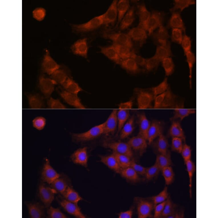 Immunofluorescence - Anti-GANAB Antibody (A87912) - Antibodies.com