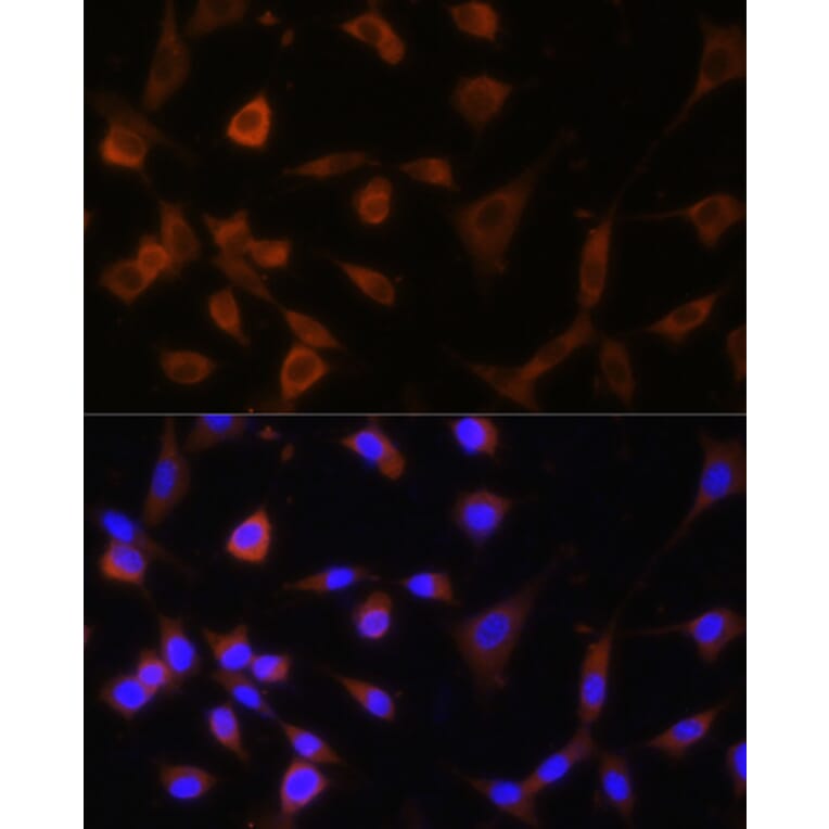 Immunofluorescence - Anti-GANAB Antibody (A87912) - Antibodies.com