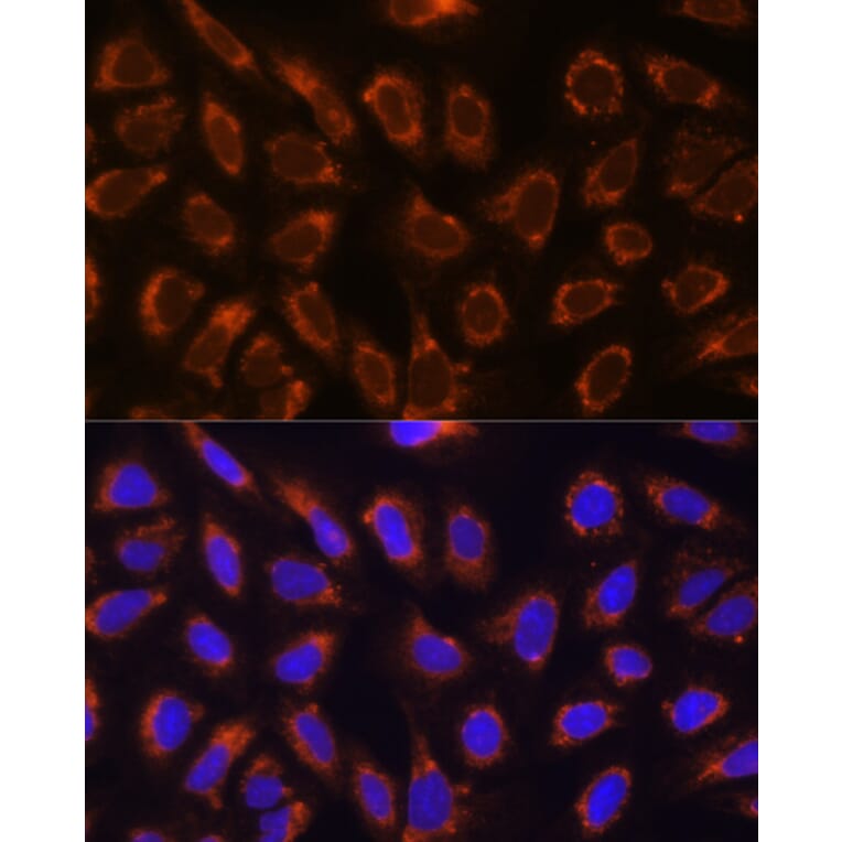 Immunofluorescence - Anti-GANAB Antibody (A87912) - Antibodies.com