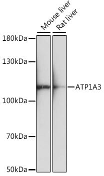 Western blot analysis of extracts of various cell lines, using Anti-ATP1A3 Antibody (A16036) at 1:1,000 dilution.
Secondary antibody: Goat Anti-Rabbit IgG (H+L) (HRP) (AS014) at 1:10,000 dilution.
Lysates / proteins: 25µg per lane.
Blocking buffer: 3% non-fat dry milk in TBST.
Detection: ECL Basic Kit (RM00020).
Exposure time: 90s.