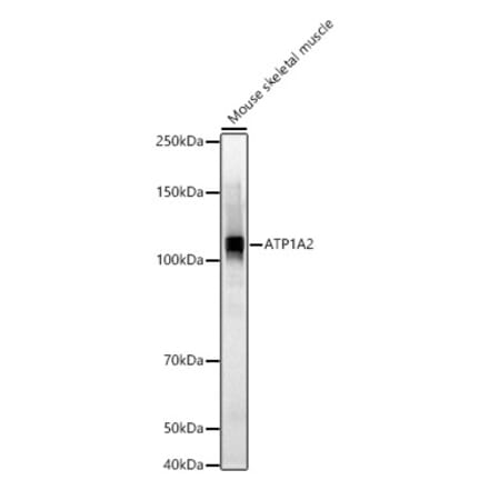 Western Blot - Anti-ATP1A2 Antibody (A87914) - Antibodies.com