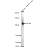 Western Blot - Anti-ATP1A2 Antibody (A87914) - Antibodies.com
