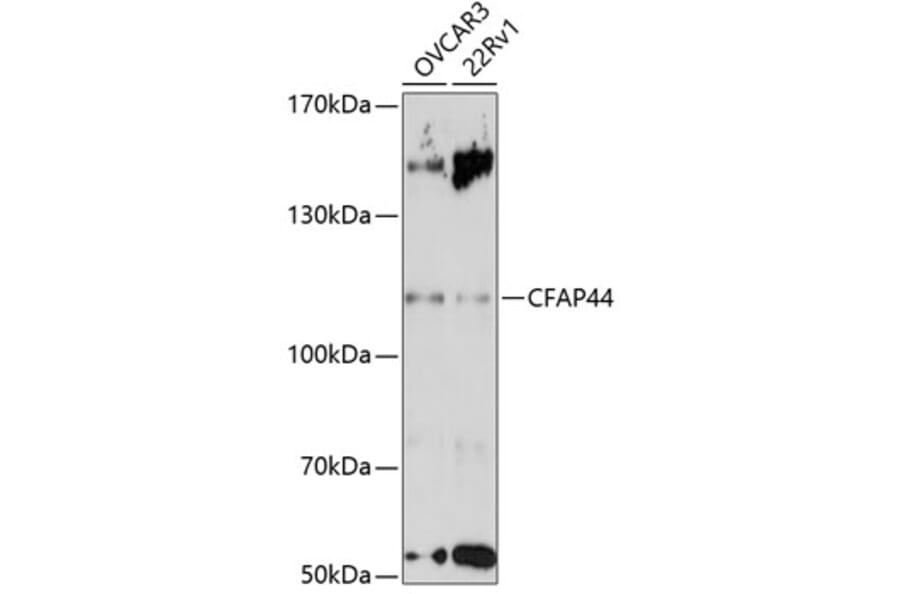 Western Blot - Anti-CFAP44 Antibody (A87915) - Antibodies.com