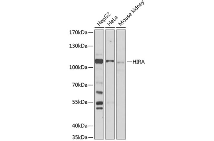 Western Blot - Anti-HIRA/HIR Antibody (A87916) - Antibodies.com