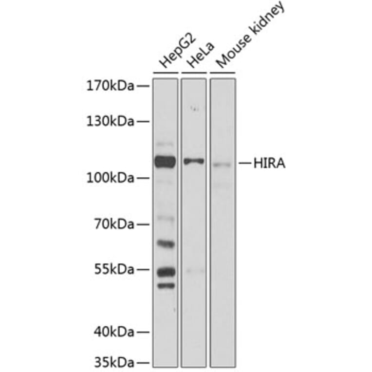 Western Blot - Anti-HIRA/HIR Antibody (A87916) - Antibodies.com