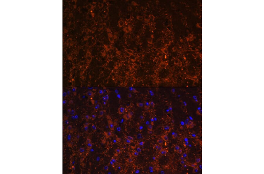 Immunofluorescence - Anti-SNX13 Antibody (A87917) - Antibodies.com