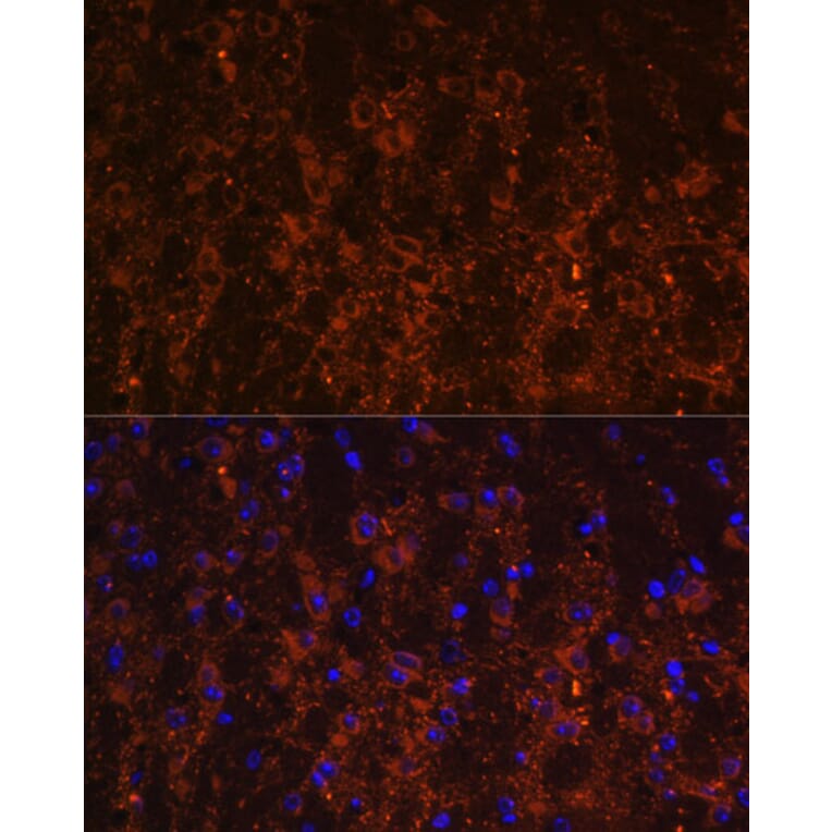 Immunofluorescence - Anti-SNX13 Antibody (A87917) - Antibodies.com