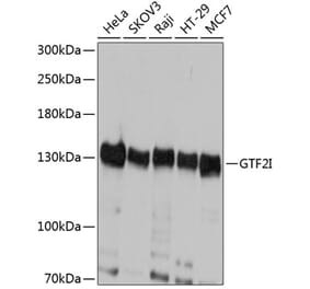 Western Blot - Anti-TFII I Antibody (A87918) - Antibodies.com