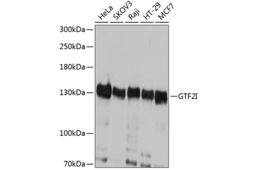 Western Blot - Anti-TFII I Antibody (A87918) - Antibodies.com