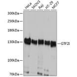 Western Blot - Anti-TFII I Antibody (A87918) - Antibodies.com