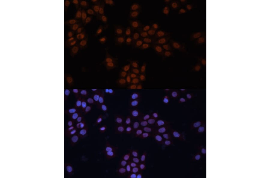 Immunofluorescence - Anti-TFII I Antibody (A87918) - Antibodies.com