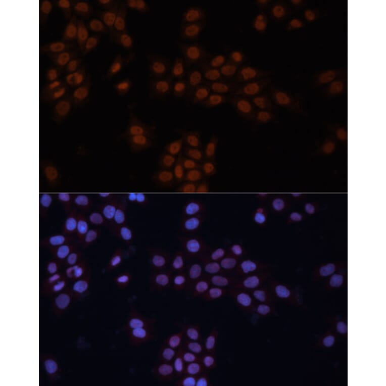 Immunofluorescence - Anti-TFII I Antibody (A87918) - Antibodies.com