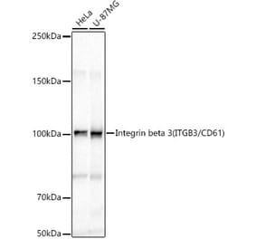 Western Blot - Anti-Integrin beta 3 Antibody (A87919) - Antibodies.com