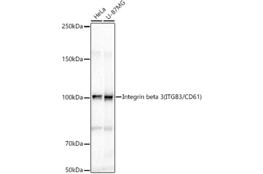 Western Blot - Anti-Integrin beta 3 Antibody (A87919) - Antibodies.com