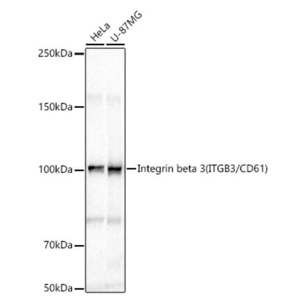 Western Blot - Anti-Integrin beta 3 Antibody (A87919) - Antibodies.com