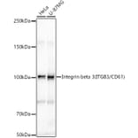 Western Blot - Anti-Integrin beta 3 Antibody (A87919) - Antibodies.com