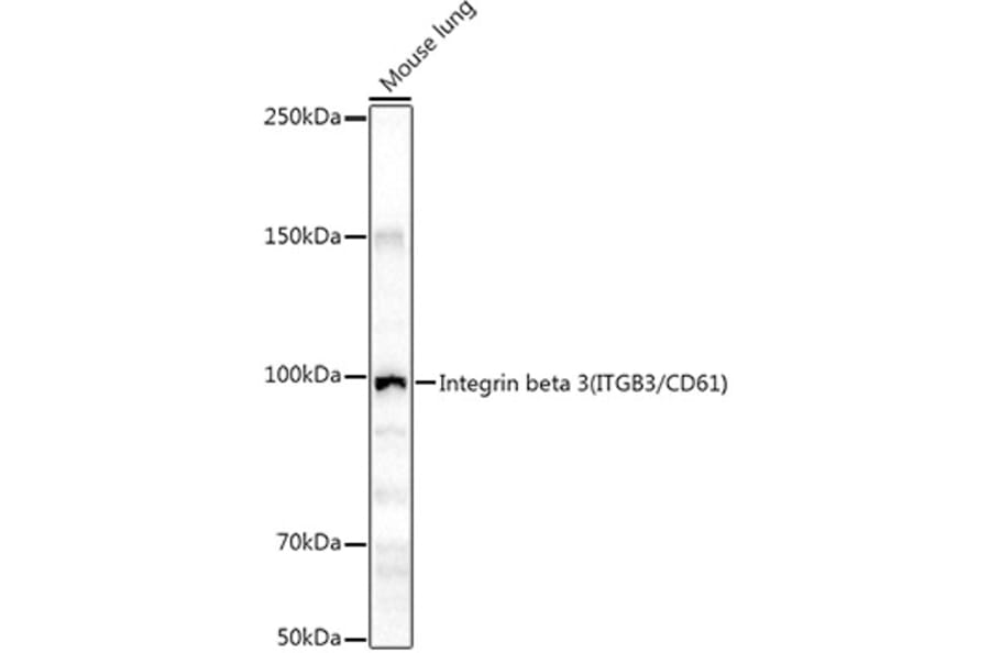 Western Blot - Anti-Integrin beta 3 Antibody (A87919) - Antibodies.com