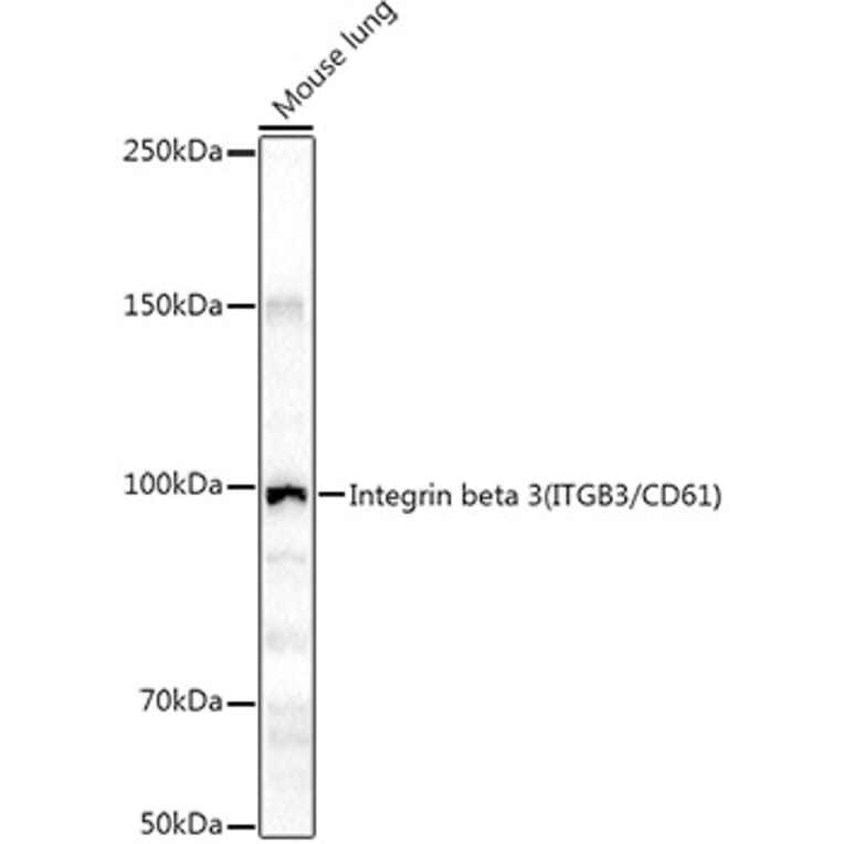 Western Blot - Anti-Integrin beta 3 Antibody (A87919) - Antibodies.com