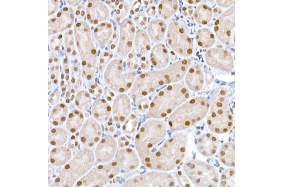 Immunohistochemistry - Anti-DNA Ligase III/LIG3 Antibody (A87920) - Antibodies.com