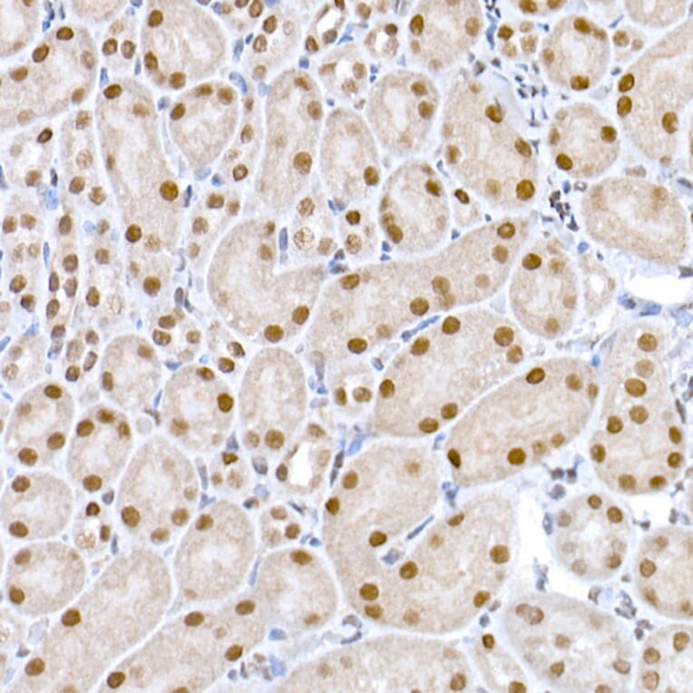 Immunohistochemistry - Anti-DNA Ligase III/LIG3 Antibody (A87920) - Antibodies.com