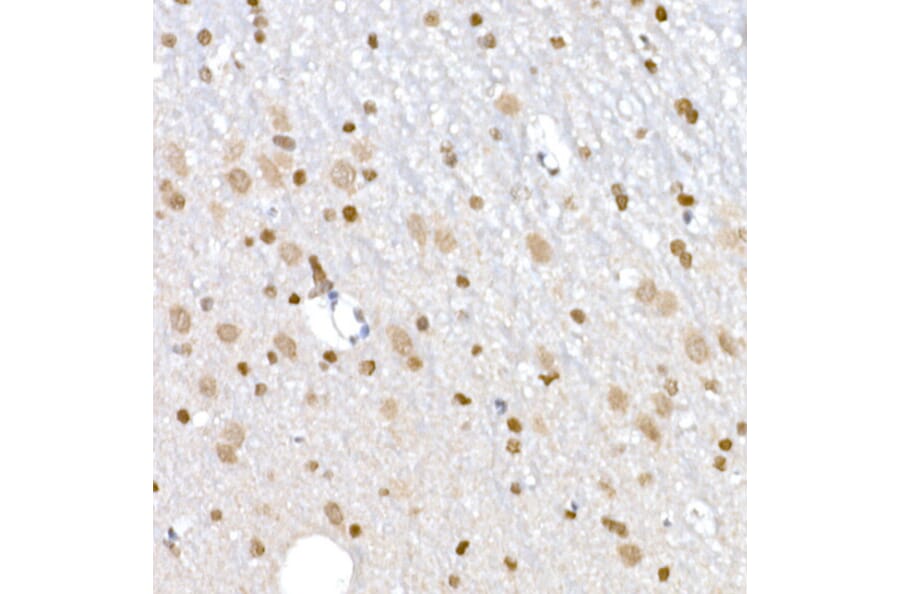 Immunohistochemistry - Anti-DNA Ligase III/LIG3 Antibody (A87920) - Antibodies.com