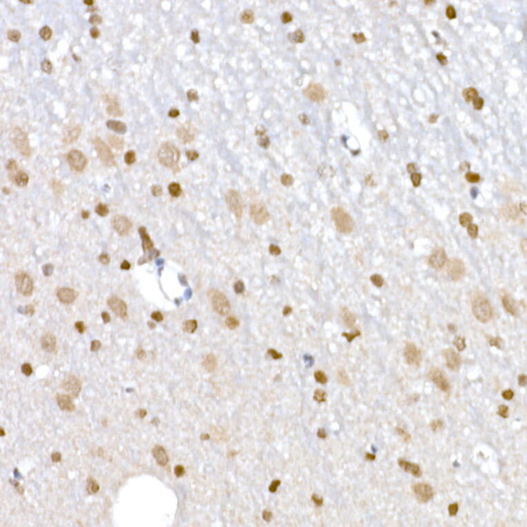 Immunohistochemistry - Anti-DNA Ligase III/LIG3 Antibody (A87920) - Antibodies.com