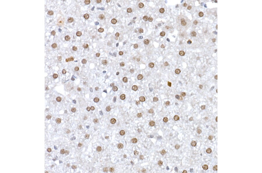 Immunohistochemistry - Anti-DNA Ligase III/LIG3 Antibody (A87920) - Antibodies.com