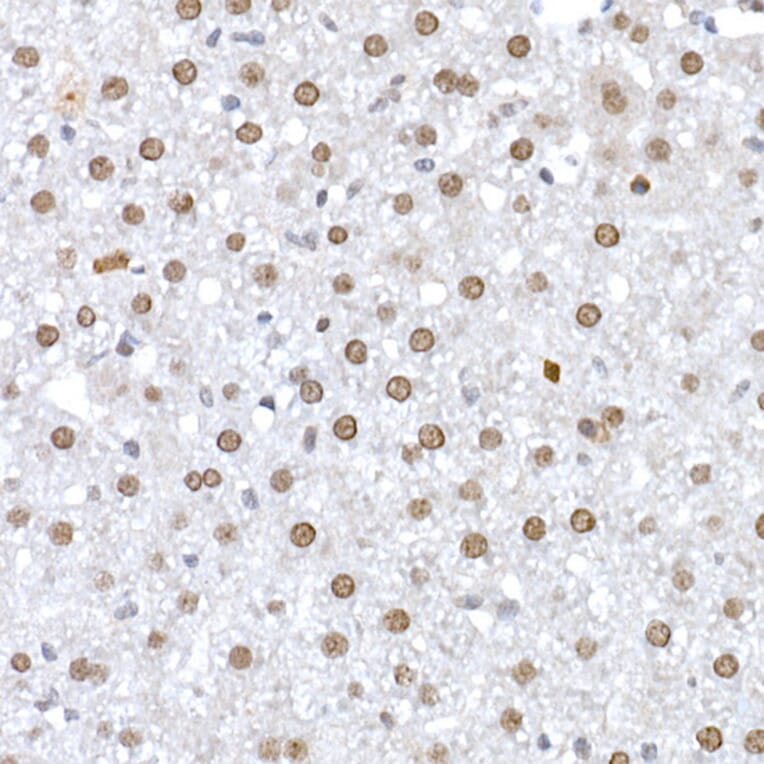 Immunohistochemistry - Anti-DNA Ligase III/LIG3 Antibody (A87920) - Antibodies.com