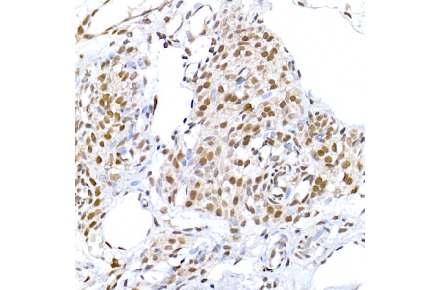 Immunohistochemistry - Anti-DNA Ligase III/LIG3 Antibody (A87920) - Antibodies.com